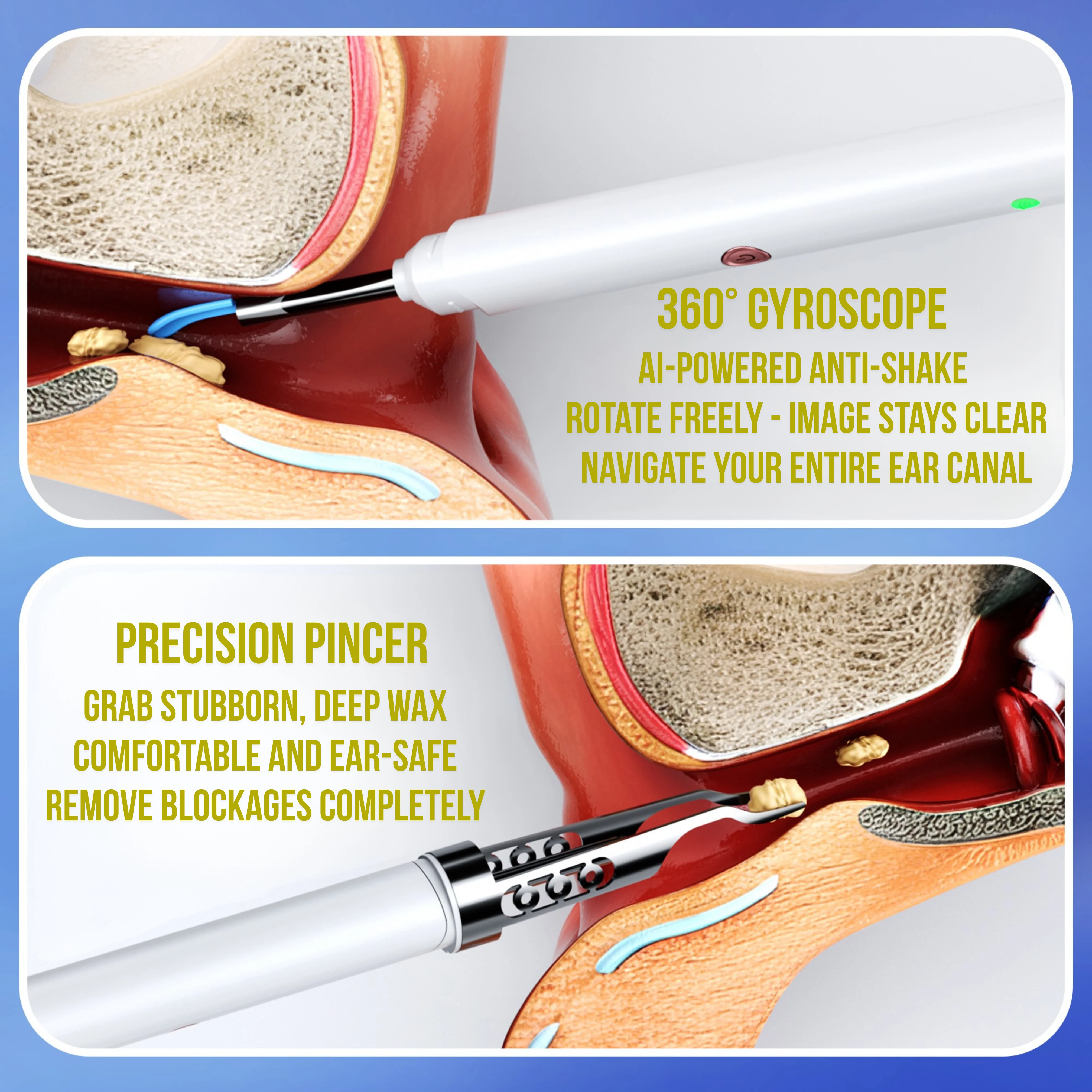 Slivor VisioEar: Doctor Approved Ear Health Technology - Image 10